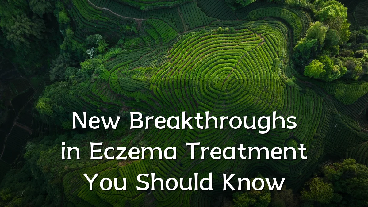 New Breakthroughs in Eczema Treatment You Should Know