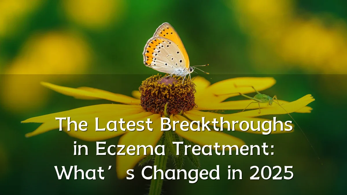 The Latest Breakthroughs in Eczema Treatment: What’s Changed in 2025